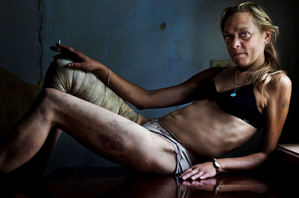 Ukrán drogos prostituált fotója győzött